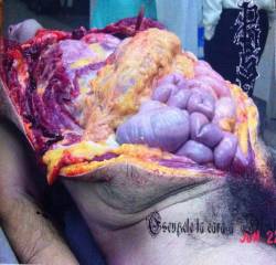 Process Of Suffocation : Escupele la Cara a Dios Process Of Suffocation : Escupele la Cara a Dios